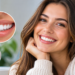 Roman Kemp Teeth