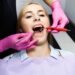 Composite Bonding